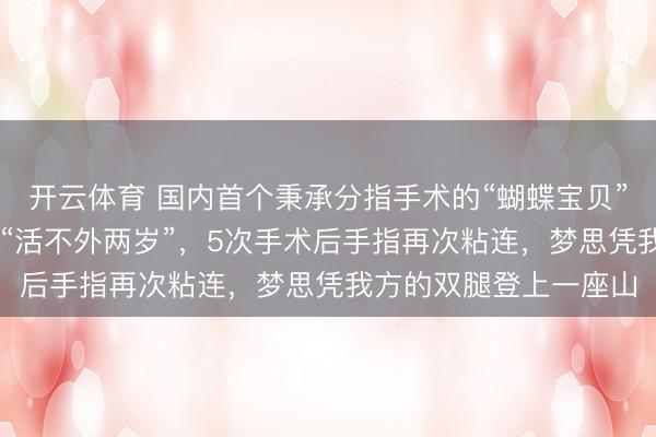 开云体育 国内首个秉承分指手术的“蝴蝶宝贝”将满25岁：曾被断言“活不外两岁”，5次手术后手指再次粘连，梦思凭我方的双腿登上一座山